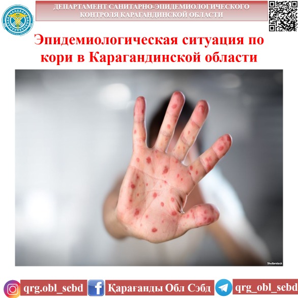 Эпидемиологическая ситуация по кори в Карагандинской области