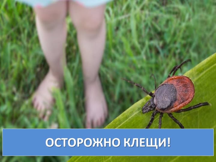 С начала эпидемического сезона 2025 года в Акмолинской области зарегистрировано 713 случаев укусов клещей, что в 2,1 раза превышает показатели аналогичного периода прошлого года, когда было зафиксировано 332 случая.