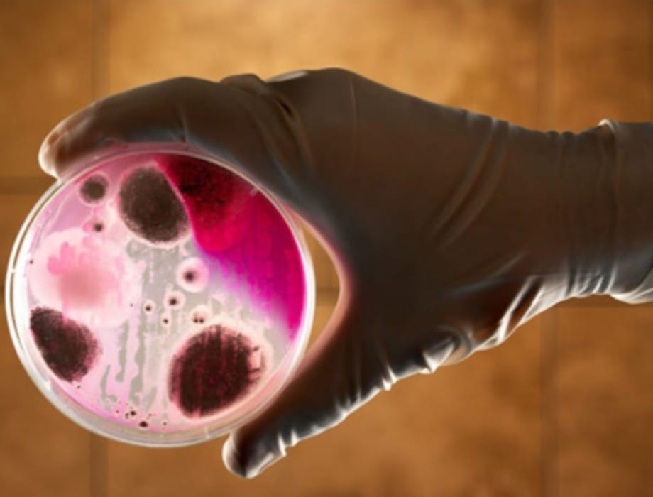 Бруцеллез- опасное заболевание!