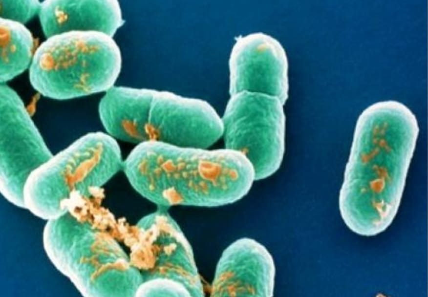 Профилактика листериоза