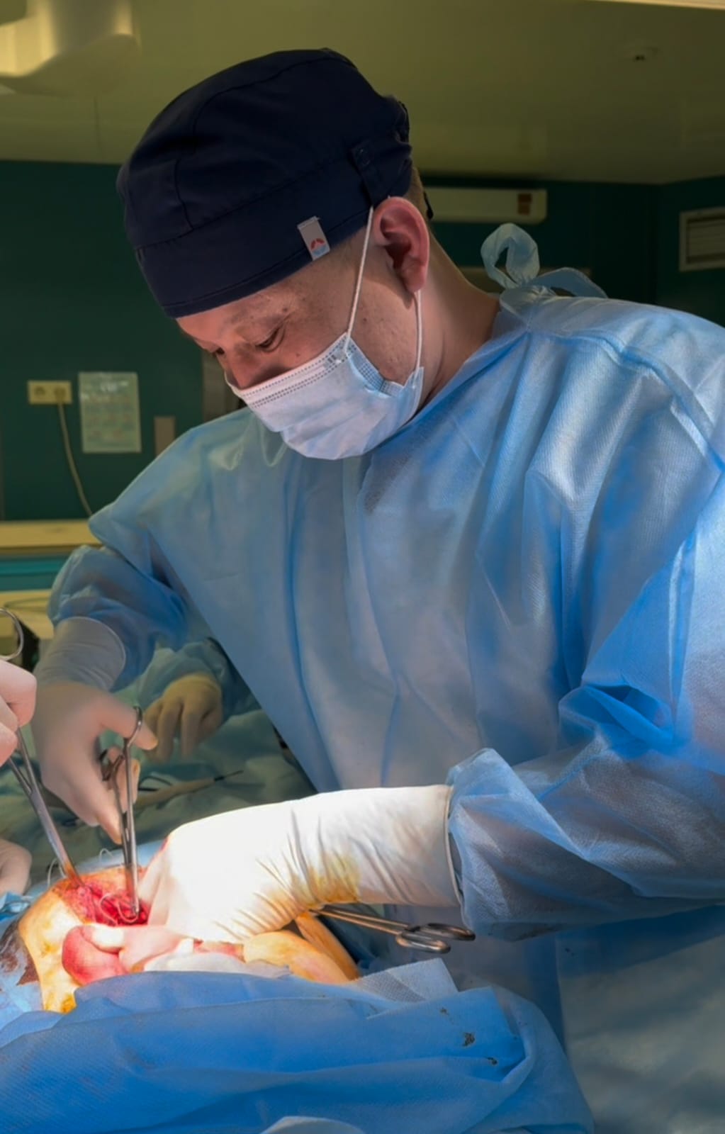 Сложный случай кишечной непроходимости: своевременная операция спасла пациентку