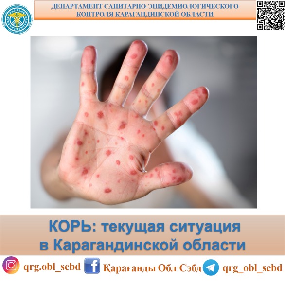 КОРЬ: текущая ситуация в Карагандинской области