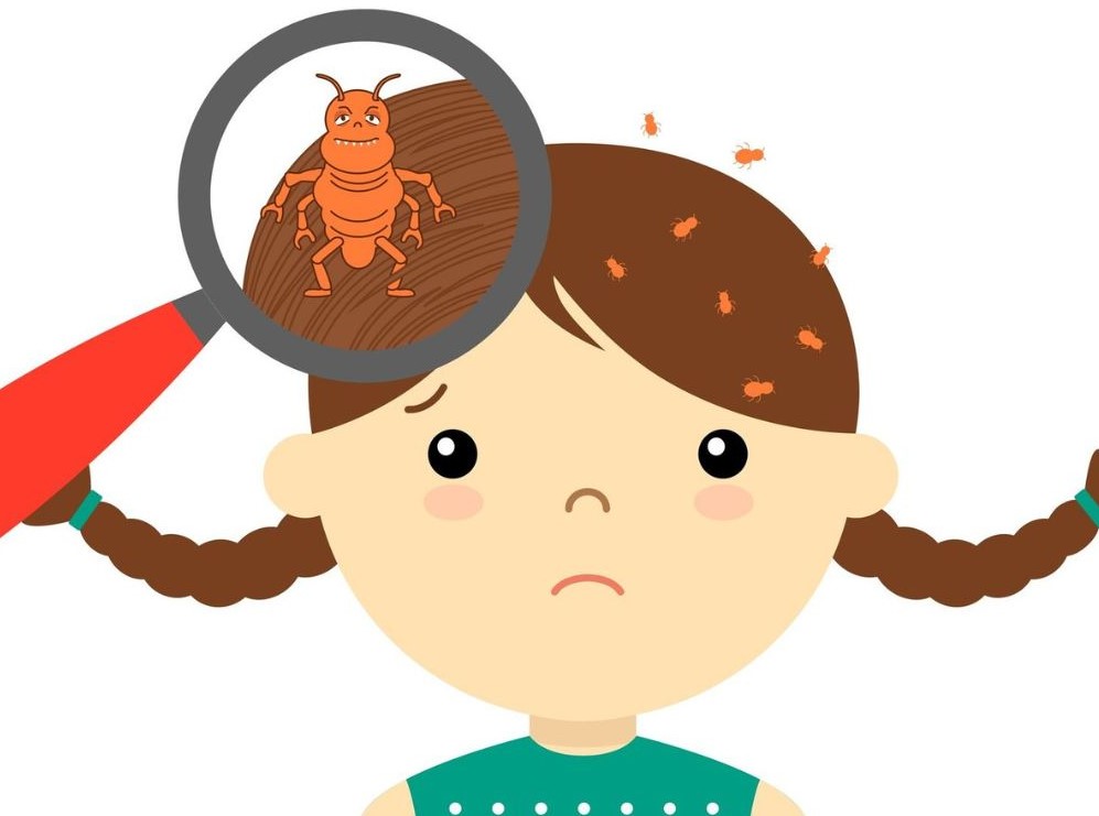 Что такое Педикулез? Основные меры профилактики.