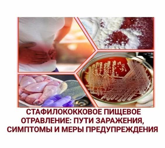 Стафилококковое пищевое отравление: пути заражения, симптомы и меры предупреждения
