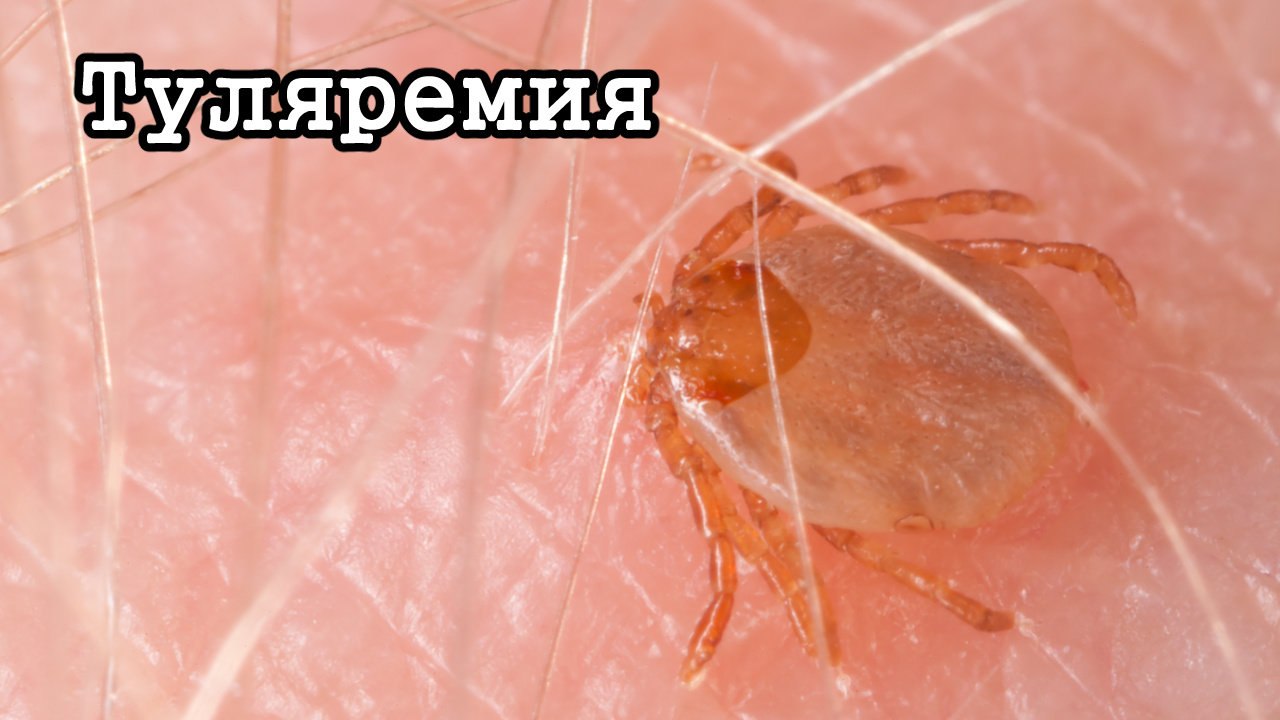 Осторожно, туляремия!