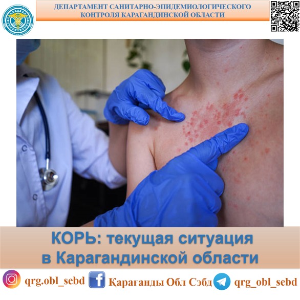 КОРЬ: текущая эпидемиологическая ситуация в Карагандинской области