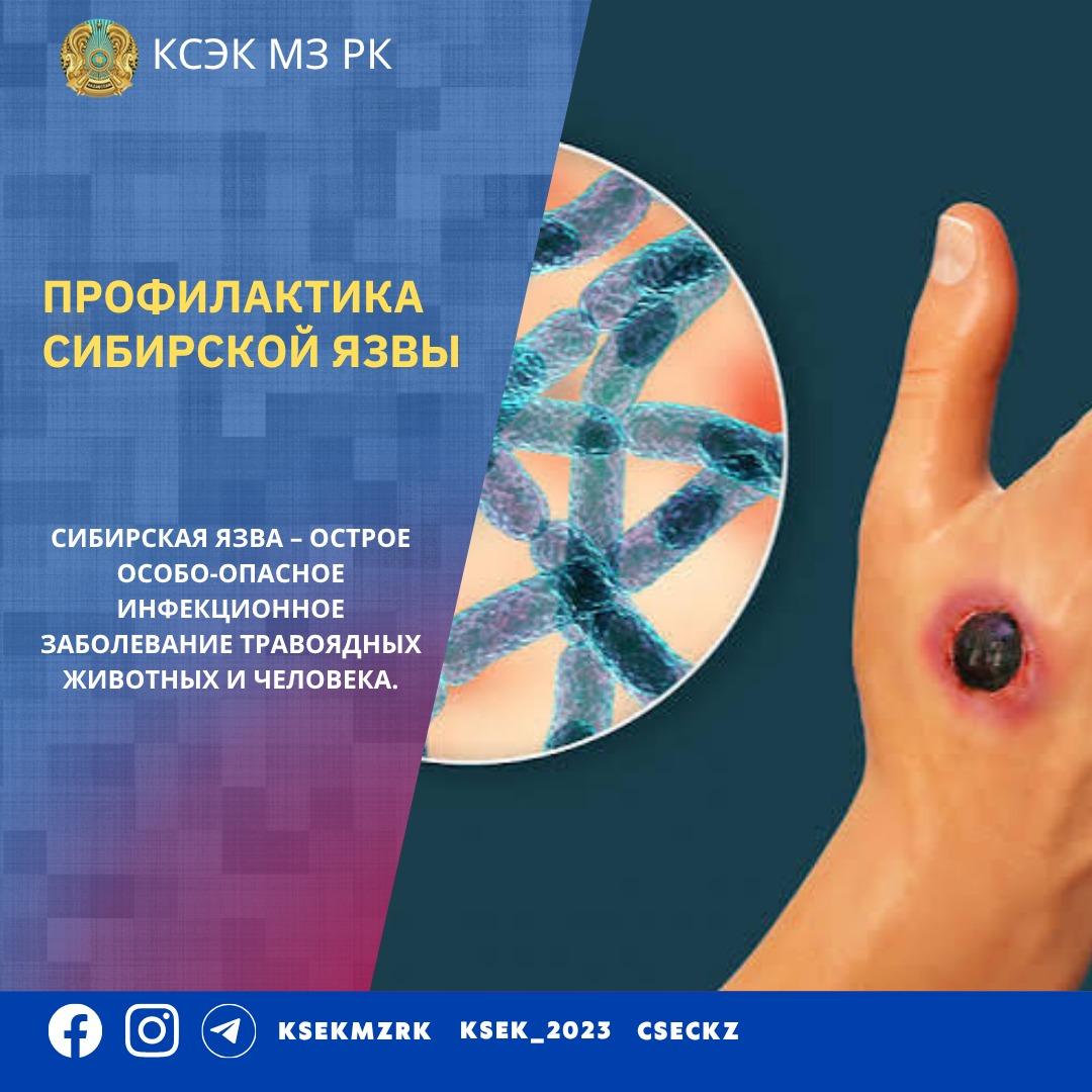 Профилактика сибирской язвы