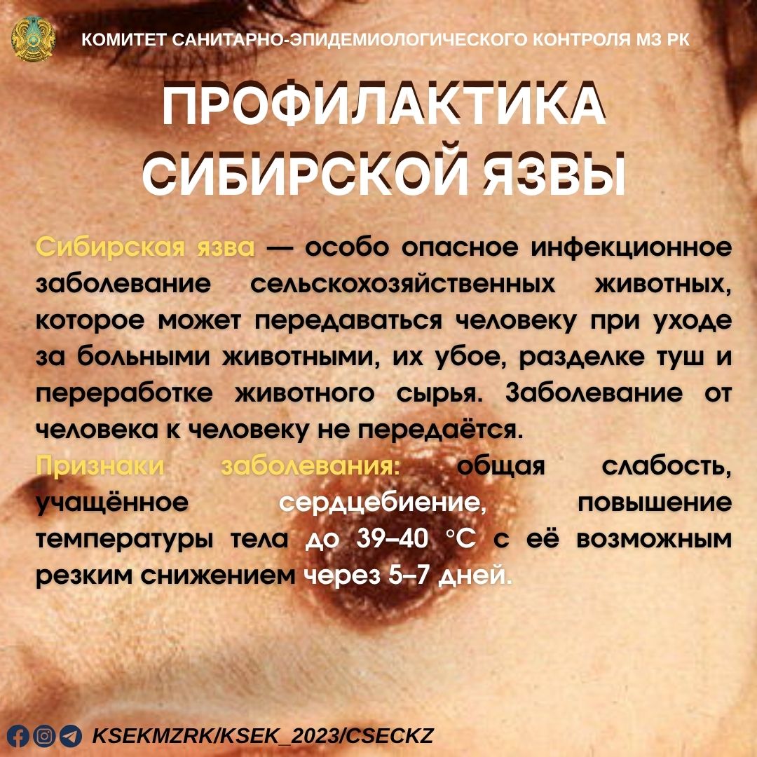 Профилактика сибирской язвы